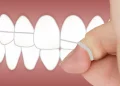 Oral Health Care