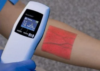 Who Should Get a Vein Finder Device