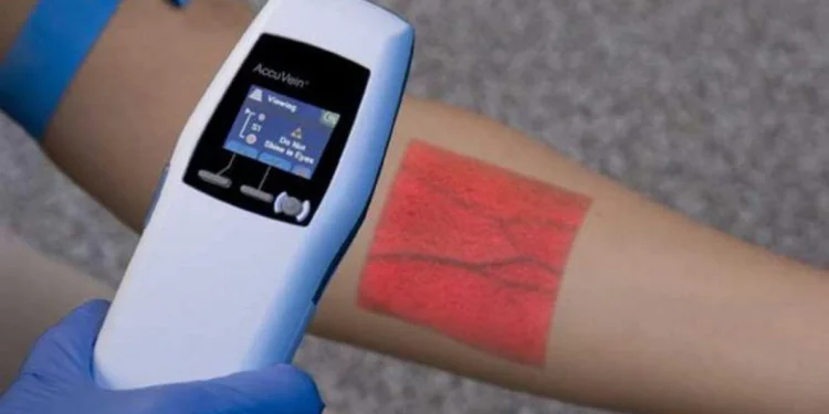 Who Should Get a Vein Finder Device