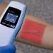 Who Should Get a Vein Finder Device