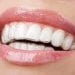 The Guide to Temporary Veneers and Dental Veneers
