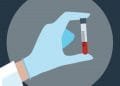 PCOS test