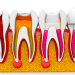 Root canal treatment