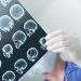 Brain Injury