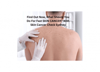 mole check sydney