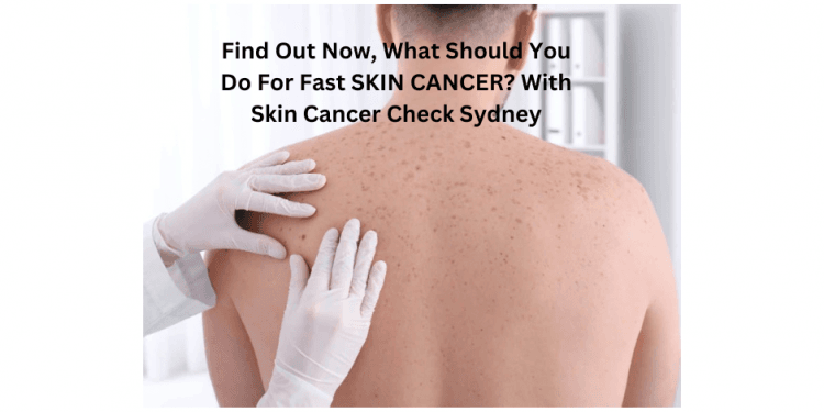 mole check sydney