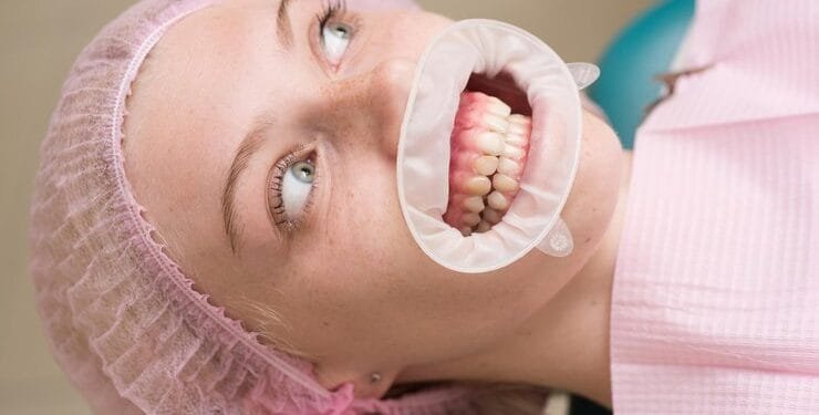 White Gums: Causes, Prevention And Treatment Approaches