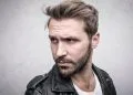 I’m Experiencing Hair Loss – What Are My Options?