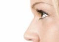 Rhinoplasty Surgery