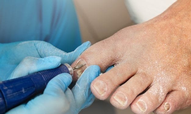 foot surgery in Perth