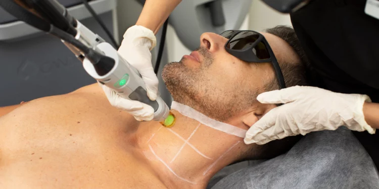 Laser Hair Removal
