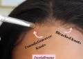 How to bleach your closure wig?