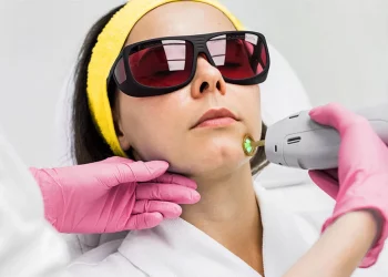 Removing hair by laser