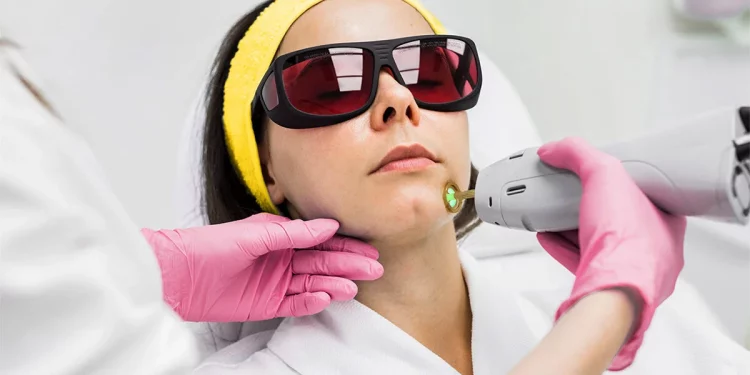 Removing hair by laser