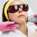 Removing hair by laser