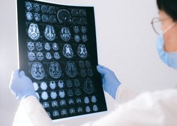 Traumatic Brain Injury Lawyer Services: What Do They Offer?