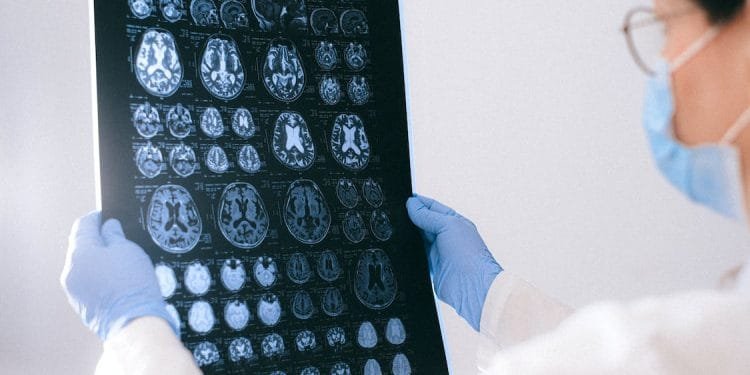 Traumatic Brain Injury Lawyer Services: What Do They Offer?